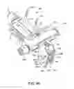 Fig. 43 - ANKLE REPLACEMENT SYSTEM AND METHOD