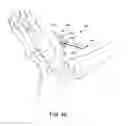 Fig. 45 - ANKLE REPLACEMENT SYSTEM AND METHOD