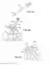 Fig. 71 - ANKLE REPLACEMENT SYSTEM AND METHOD