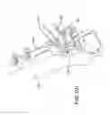 Fig. 85 - ANKLE REPLACEMENT SYSTEM AND METHOD