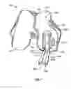 Fig. 09 - Patient-specific partial knee guides and other instruments