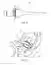 Fig. 33 - ULTRASONIC AND ELECTROSURGICAL DEVICES