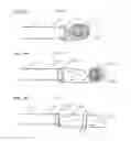Fig. 22 - Methods And Systems For Performing Submucosal Medical Procedures