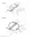 Fig. 45 - Methods And Systems For Performing Submucosal Medical Procedures