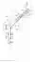 Fig. 01 - Plate-based compliant hip fixation system