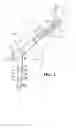 Fig. 02 - Plate-based compliant hip fixation system