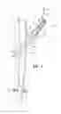 Fig. 02 - Hip fixation system with a compliant fixation element
