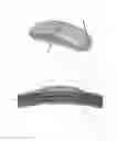 Fig. 02 - Bone plate system and method