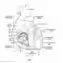 Fig. 02 - Pericardial catheter with temperature sensing array