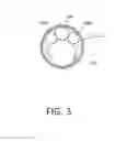 Fig. 04 - Tissue extraction devices and methods