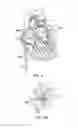 Fig. 08 - NEEDLE CATHETER UTILIZING OPTICAL SPECTROSCOPY FOR TUMOR IDENTIFICATION AND ABLATION