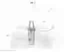 Fig. 02 - DENTAL IMPLANT
