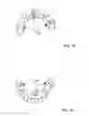 Fig. 04 - DENTAL BRIDGE ATTACHMENT SYSTEM AND METHOD