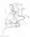 Fig. 02 - Saliva management system with continuous flow through oral device