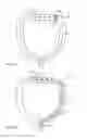 Fig. 05 - Saliva management system with continuous flow through oral device