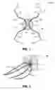 Fig. 02 - Hernia repair device and method