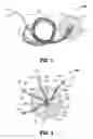 Fig. 03 - Hernia repair device and method