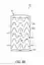 Fig. 08 - Debranching visceral stent graft and methods for use