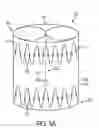 Fig. 09 - Debranching visceral stent graft and methods for use
