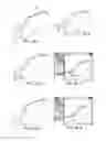 Fig. 11 - Patient Selectable Knee Joint Arthroplasty Devices