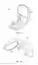 Fig. 17 - Patient Selectable Knee Joint Arthroplasty Devices