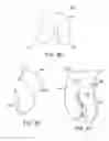 Fig. 20 - Patient Selectable Knee Joint Arthroplasty Devices