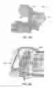 Fig. 30 - Patient Selectable Knee Joint Arthroplasty Devices
