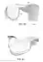 Fig. 31 - Patient Selectable Knee Joint Arthroplasty Devices