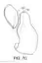 Fig. 34 - Patient Selectable Knee Joint Arthroplasty Devices