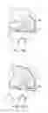 Fig. 38 - Patient Selectable Knee Joint Arthroplasty Devices