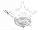 Fig. 01 - Method of implanting a curable implant material