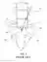 Fig. 07 - Spinal surgery apparatus and method