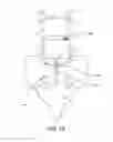 Fig. 43 - Spinal surgery apparatus and method