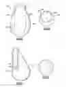 Fig. 04 - Implantable end pad