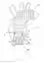 Fig. 01 - Device for endovascular aortic repair and method of using the same
