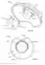 Fig. 06 - BRACE HAVING AN INFLATION CONTROL