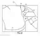 Fig. 13 - SEMI-RIGID SHOULDER BRACES AND RELATED METHODS