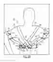Fig. 19 - SEMI-RIGID SHOULDER BRACES AND RELATED METHODS