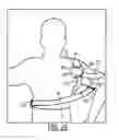 Fig. 20 - SEMI-RIGID SHOULDER BRACES AND RELATED METHODS
