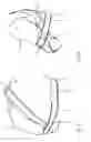 Fig. 03 - ORTHOSIS FOR FIXING A SHOULDER JOINT