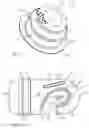 Fig. 08 - ORTHOSIS FOR FIXING A SHOULDER JOINT