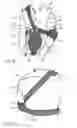 Fig. 10 - ORTHOSIS FOR FIXING A SHOULDER JOINT