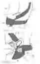 Fig. 11 - ORTHOSIS FOR FIXING A SHOULDER JOINT