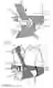 Fig. 12 - ORTHOSIS FOR FIXING A SHOULDER JOINT