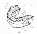 Fig. 02 - Occlusion splint arrangement