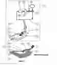 Fig. 02 - WOUND CLEANSING APPARATUS WITH SCAFFOLD