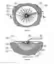 Fig. 08 - WOUND CLEANSING APPARATUS WITH SCAFFOLD