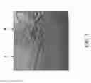 Fig. 04 - Pharmaceutical glass packaging assuring pharmaceutical sterility