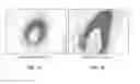 Fig. 02 - NUTRITIONAL APPROACH TO IMPROVING ATHLETIC PERFORMANCE AND REDUCING INJURY WITH L-ERGOTHIONEINE AND/OR VITAMIN D2
