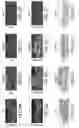 Fig. 07 - Generation of human induced pluripotent stem cells using nucleic acid sequences that inhibit Δ-NP63 and DGCR8